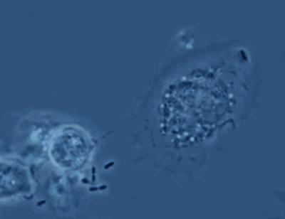 在显微镜下看癌细胞的扩散gif图片